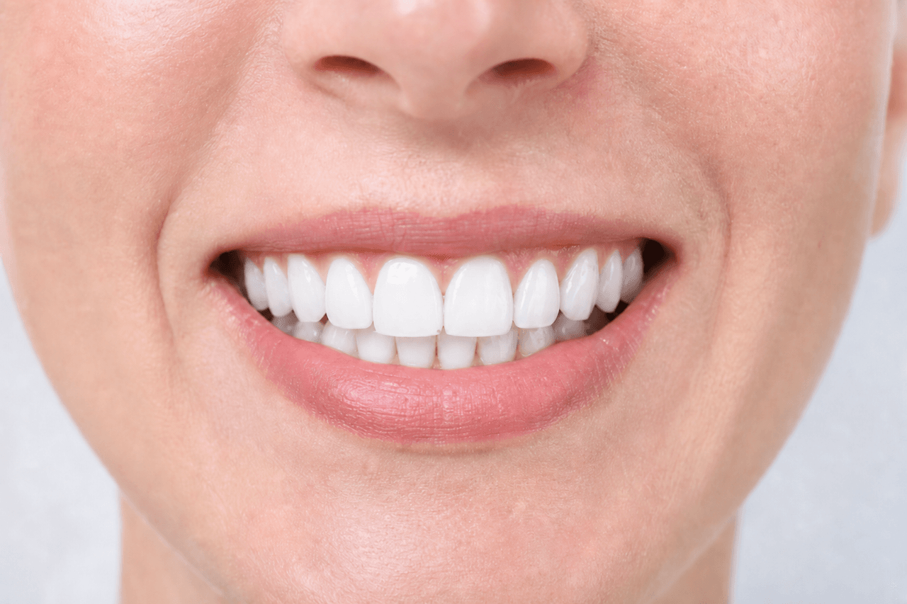After — Deep stain lift — natural shade